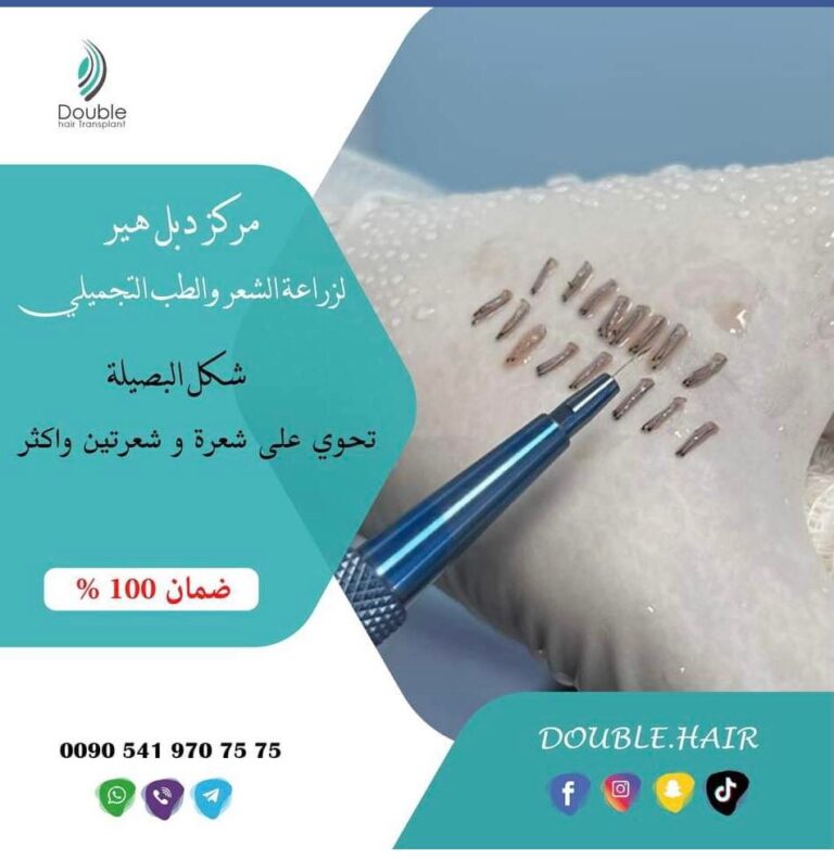 استخراج البصيلة 768x791