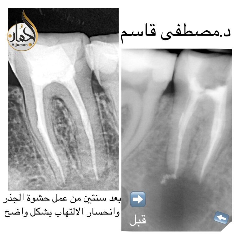 اشعة اسنان 768x768