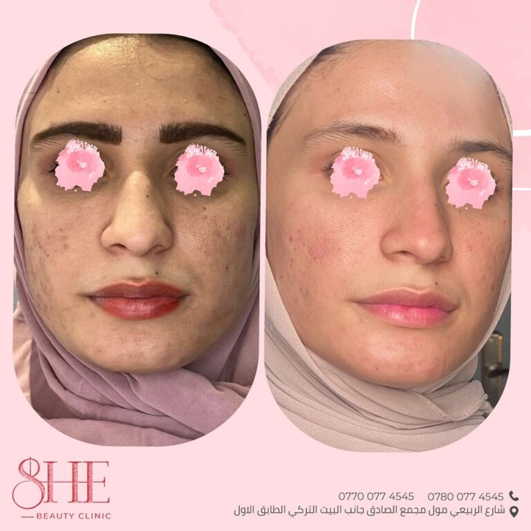 التغير الشامل 768x768