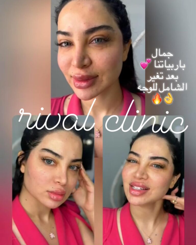 التغيير الشامل 1 1 768x960