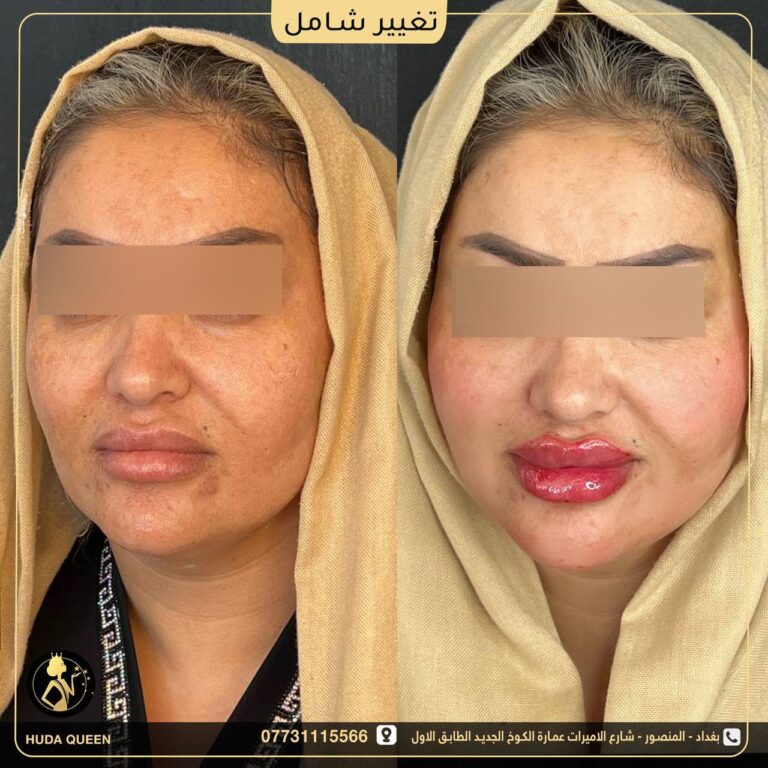 التغيير الشامل 1 768x768