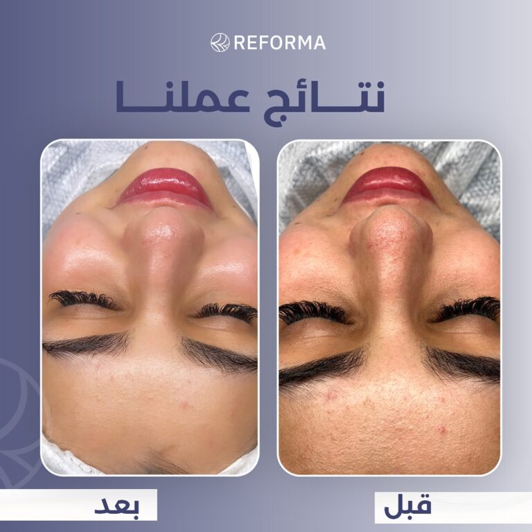 التغيير الشامل 10 768x767