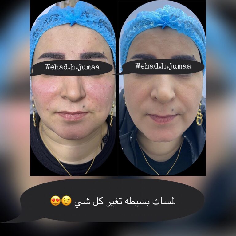 التغيير الشامل 3 768x768