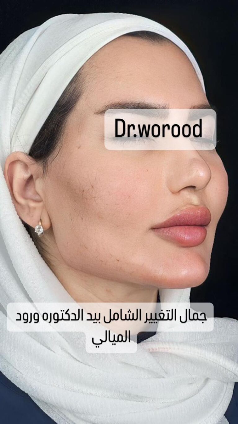 التغيير الشامل 6 768x1365