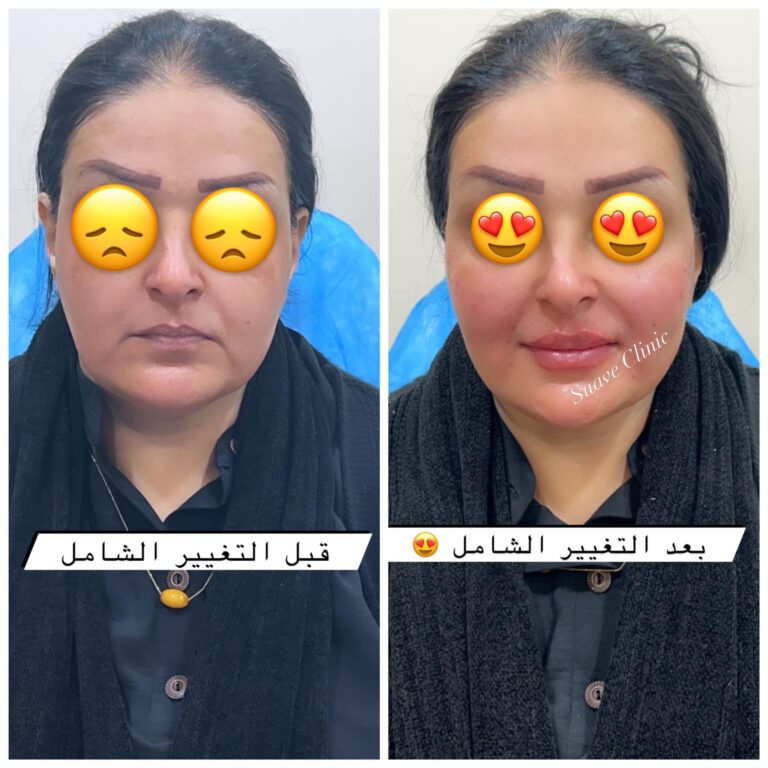 التغيير الشامل 8 768x768