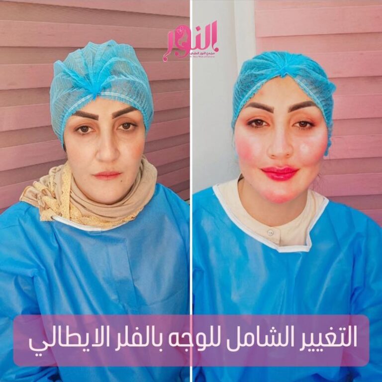 التغيير الشامل للوجه 768x768