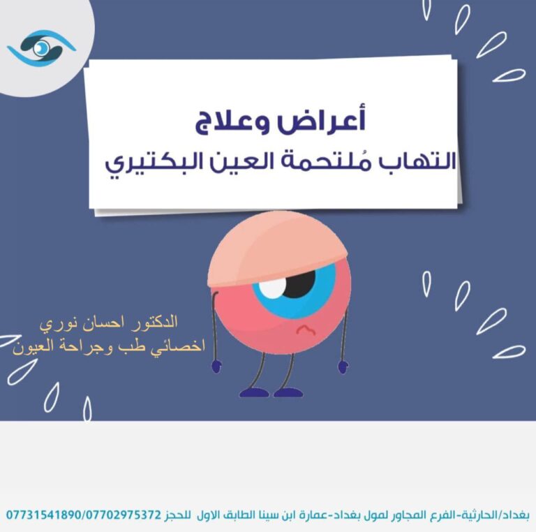 التهاب العين 768x762