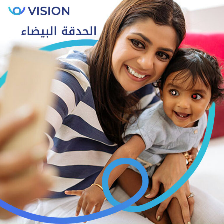 الحدقة البيضاء 768x768