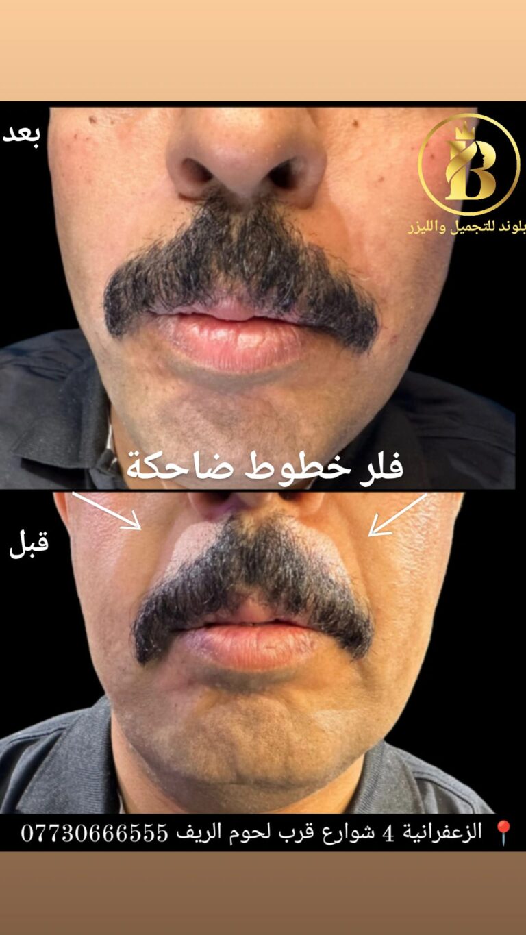 الخطوط الضاحكه 768x1365