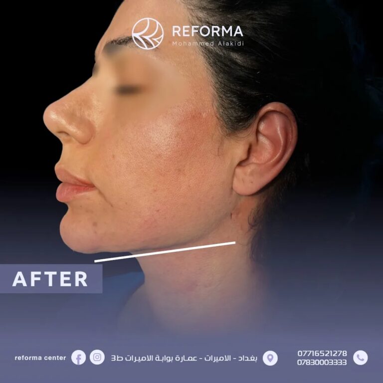 الذقن المزدوج 1 768x768