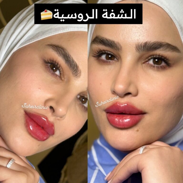 الشفه الروسيه 1 768x768