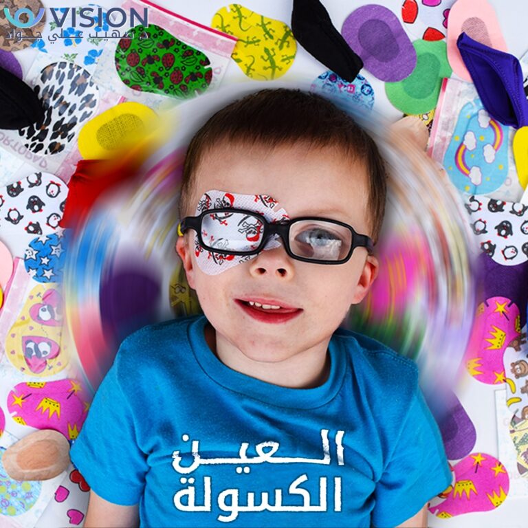 العين الكسوله 1 768x768