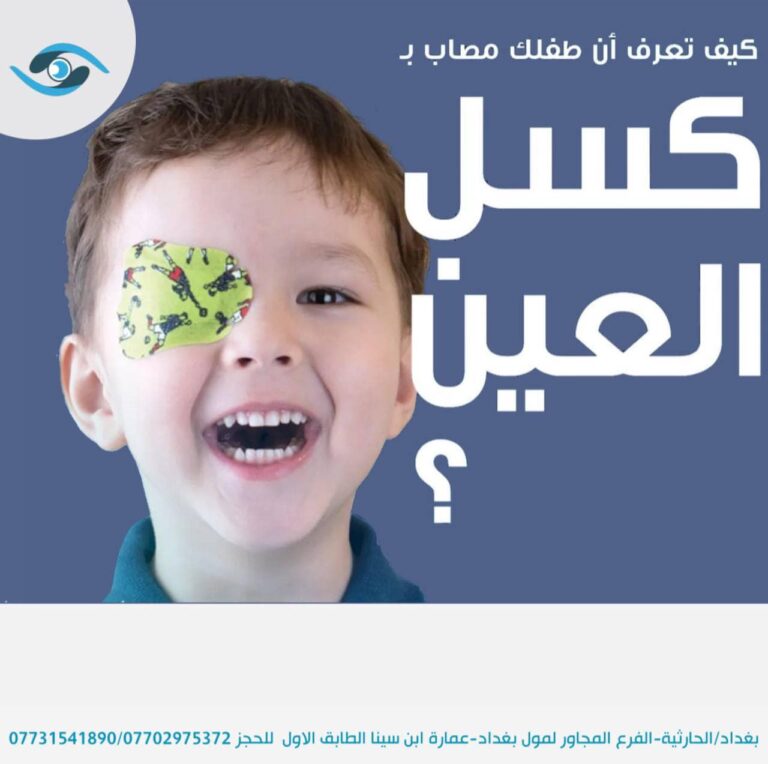 العين الكسوله 2 768x764