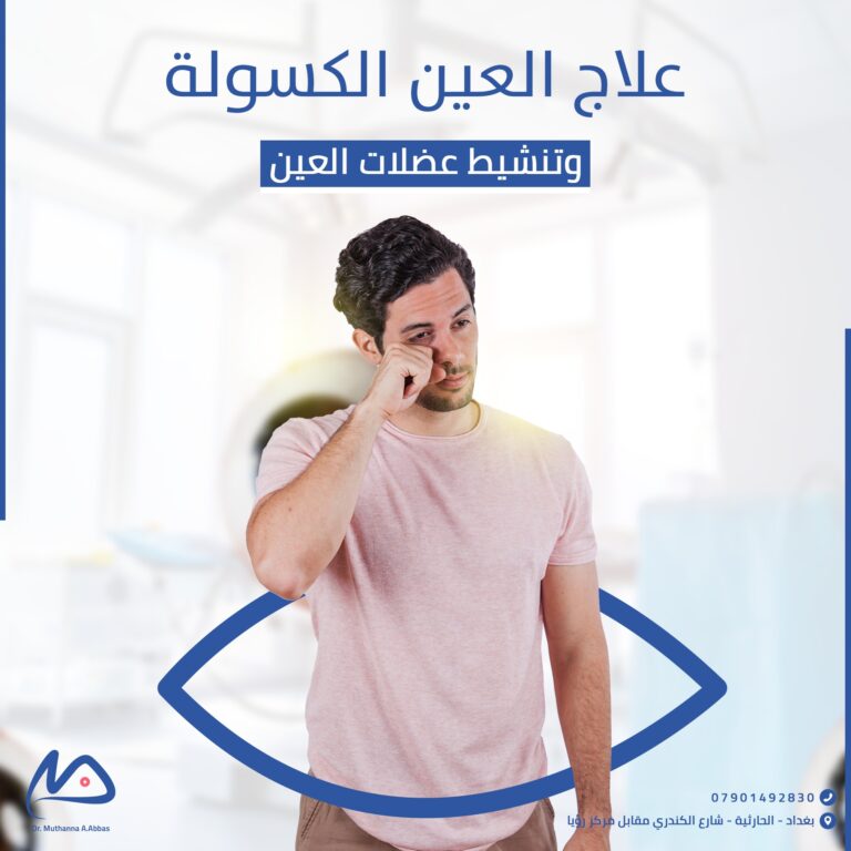 العين الكسوله 3 768x768