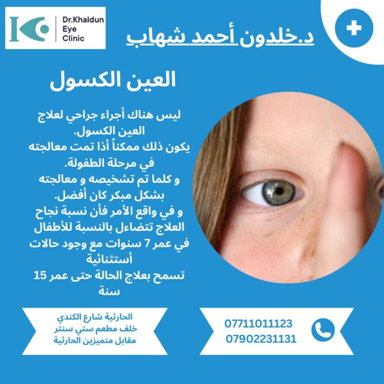 العين الكسوله 768x768
