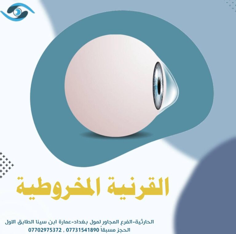 القرنيه المخروطيه 1 768x759