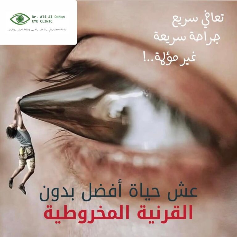 القرنيه المخروطيه 2 768x766