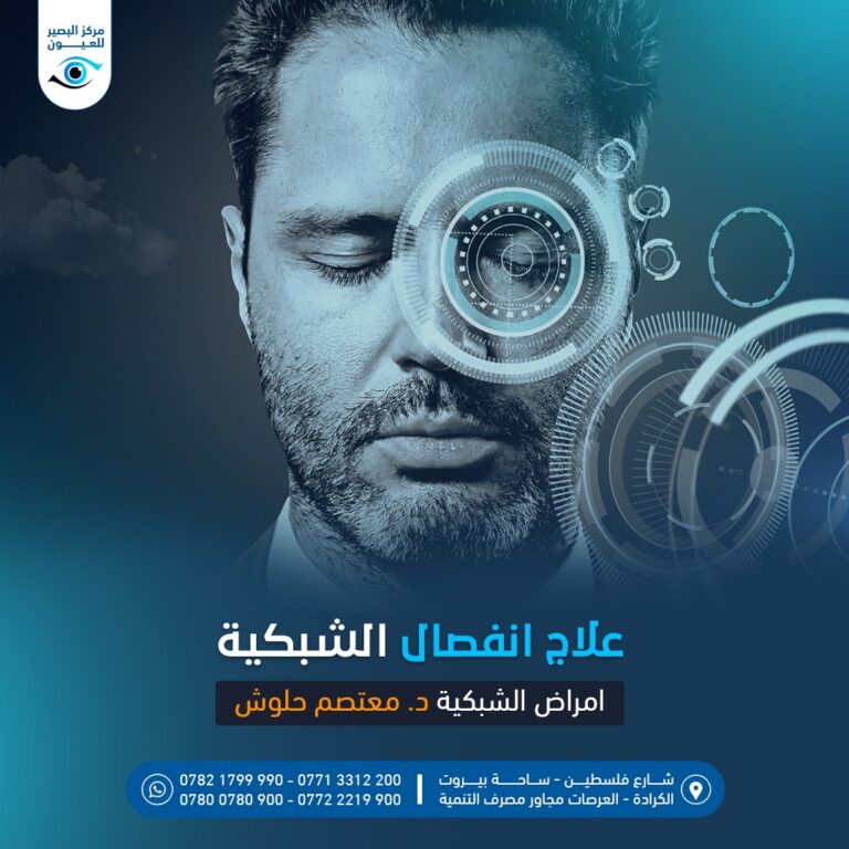 انفصال الشبكيه 1 768x768