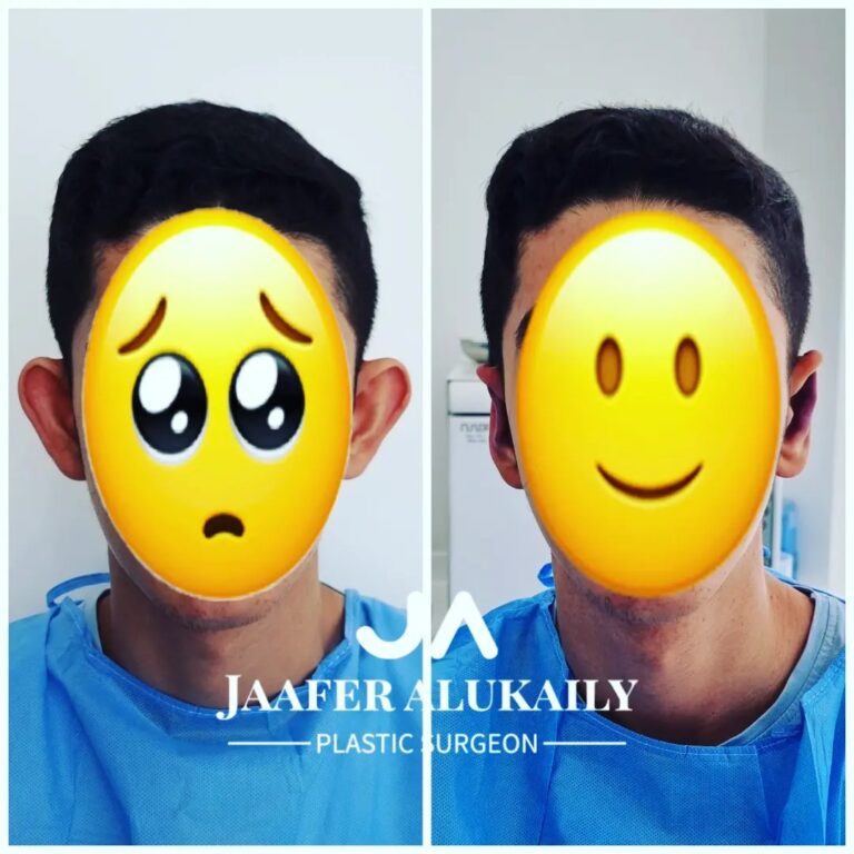 بروز الاذن 768x768