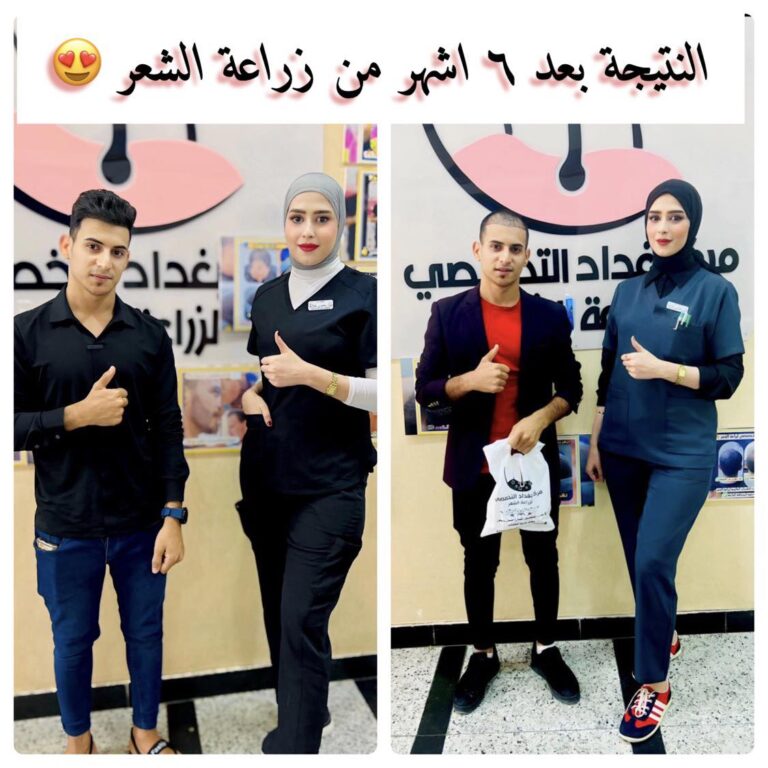 بعد 6 اشهر من الزراعة 768x768