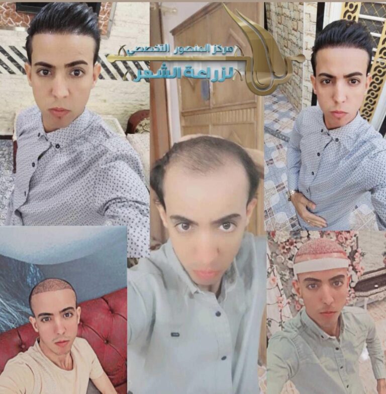 بعد الزراعة 1 768x782