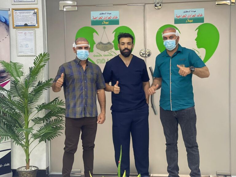 بعد الزراعة 2 768x576