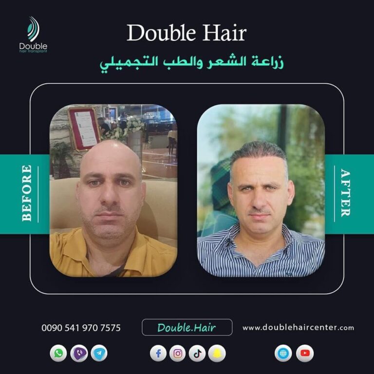 بعد الزراعة 4 768x768