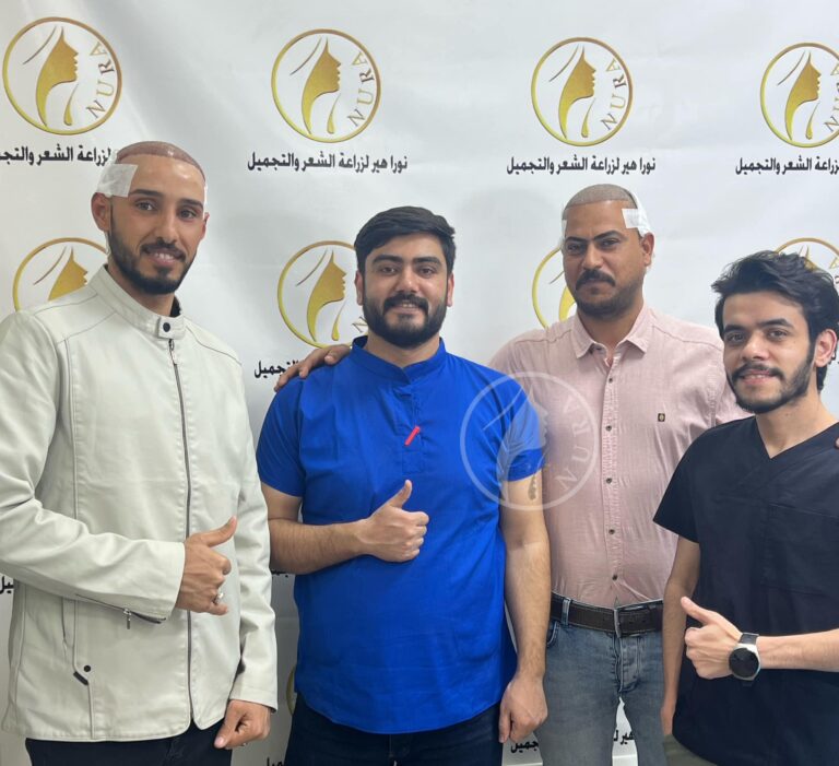 بعد الزراعه 768x701