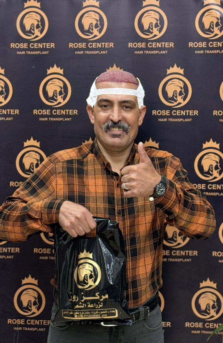 بعد العمليه 768x1179