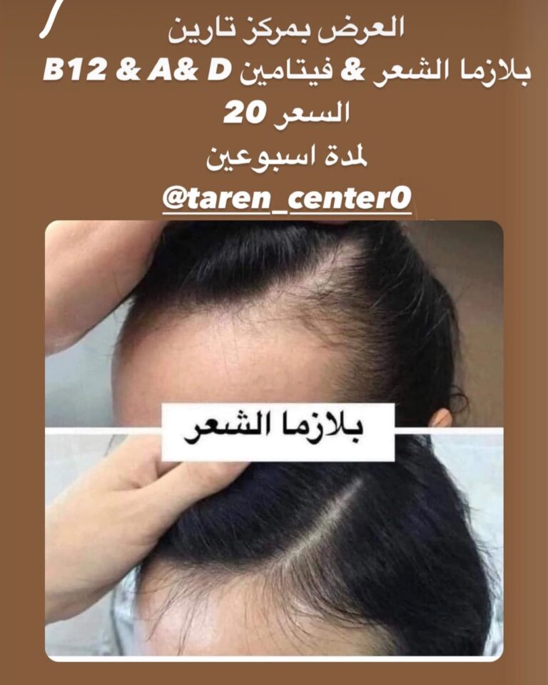 بلازما الشعر 1 768x960