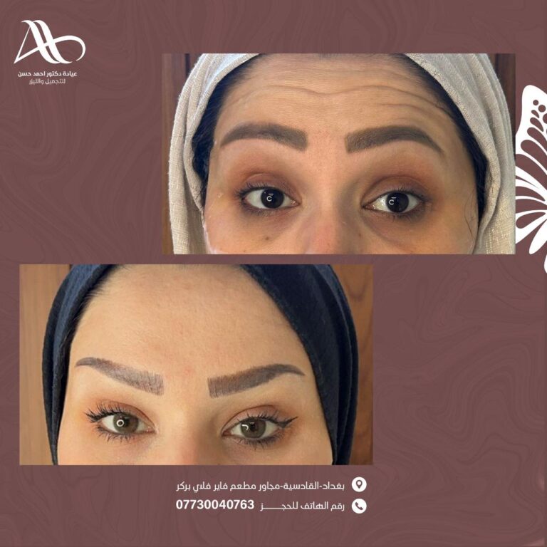 بوتكس جبين 768x768