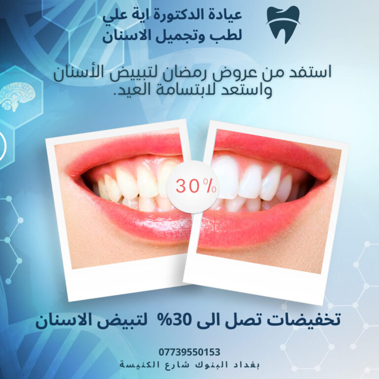 تبييض الاسنان 768x768