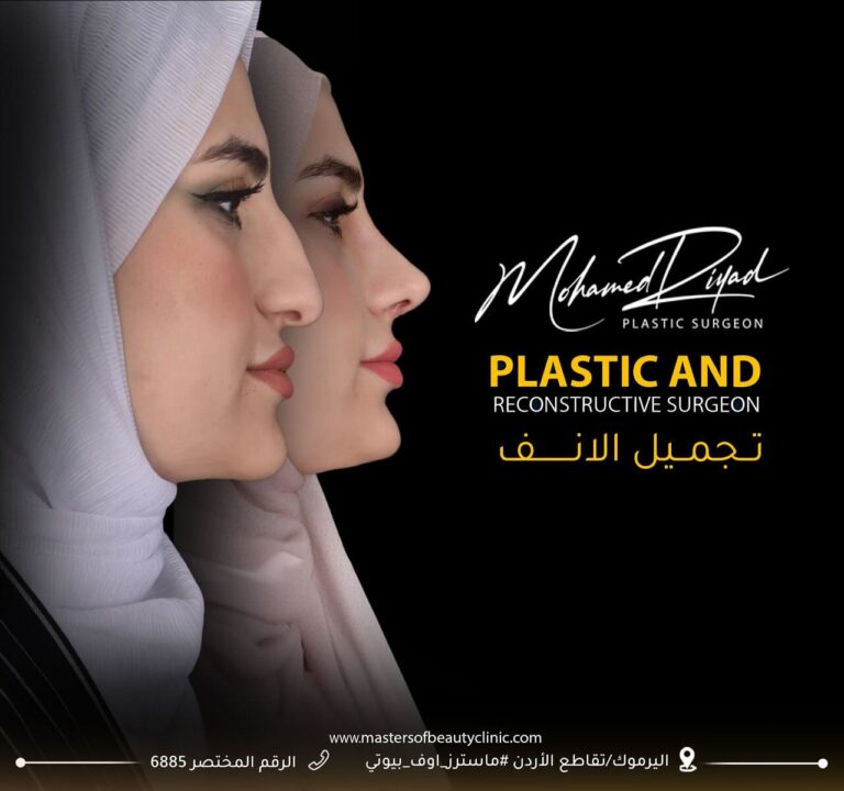 تجميل الانف 6 768x720