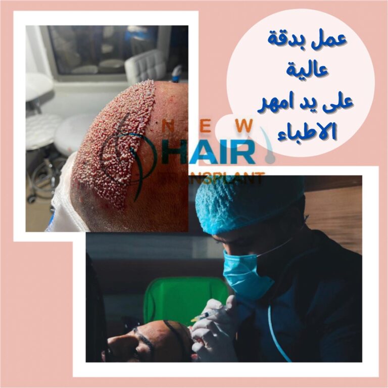 تحديد 2 768x768