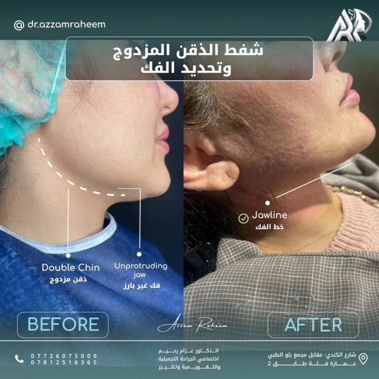 تحديد الفك 768x768