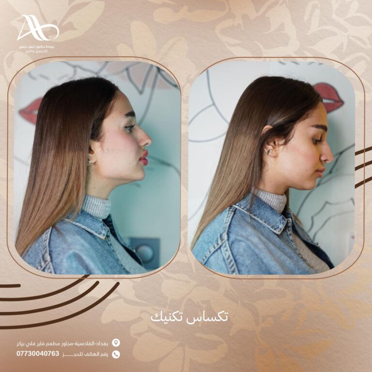 تحديد عظمه الفك 768x768