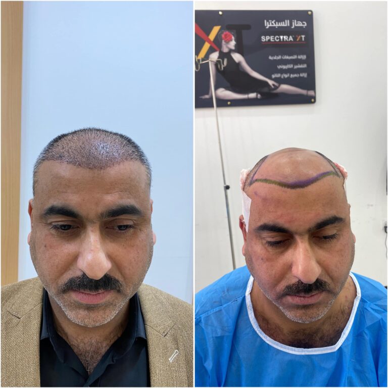 تحديد مناطق الزراعة 768x768