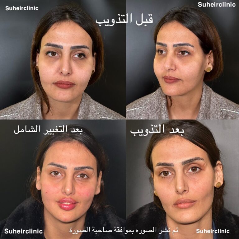 تذويب وتغيير الوجه 768x768