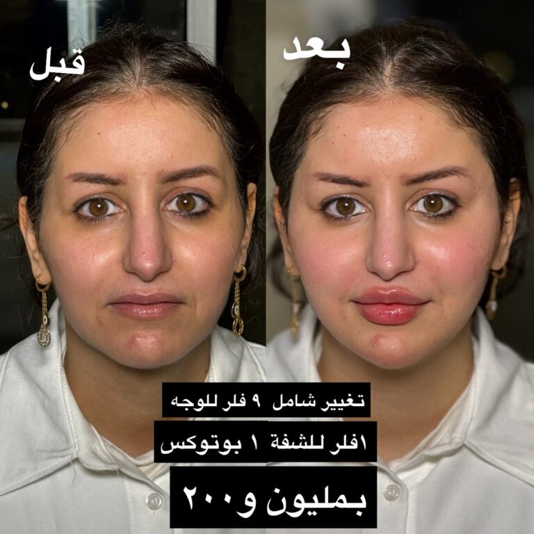 تغيير الشامل 768x768