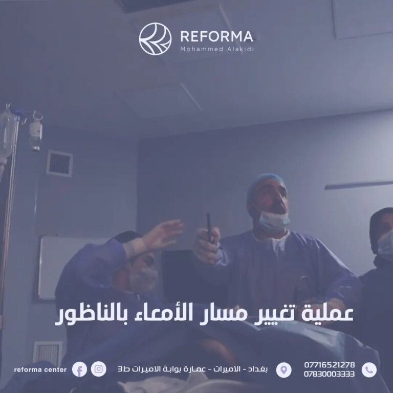 تغيير مسار الامعاء 768x768