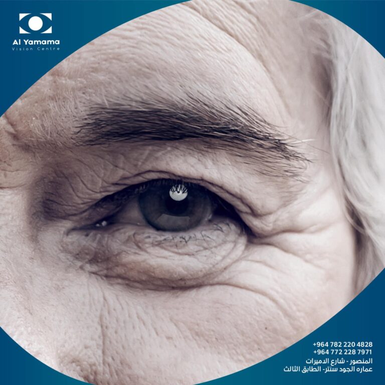 تقدم بالعمر جراحه 768x768