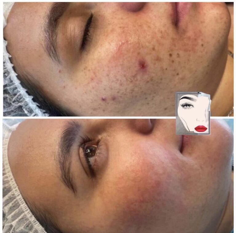 تقشير عضوي 768x760