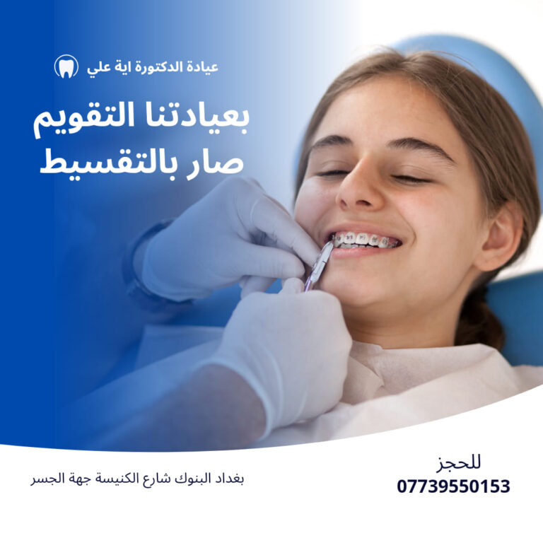 تقويم الاسنان 1 768x768