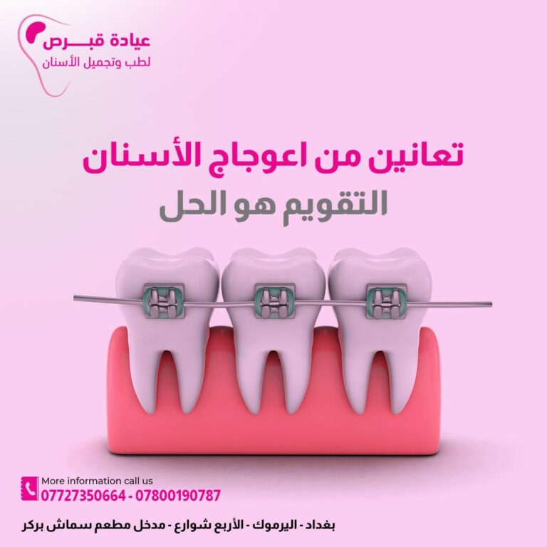 تقويم الاسنان 768x768