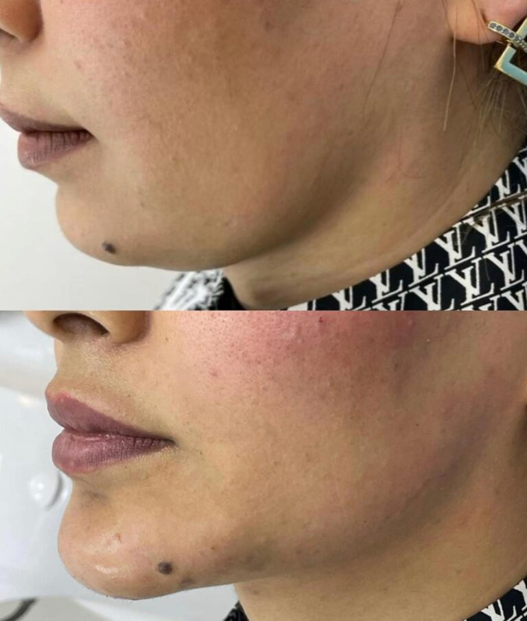 تكساس تكنيك 768x906