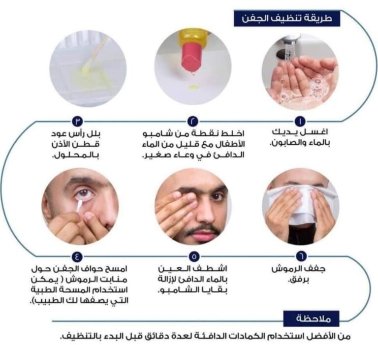 تنظيف الاجفان 768x701