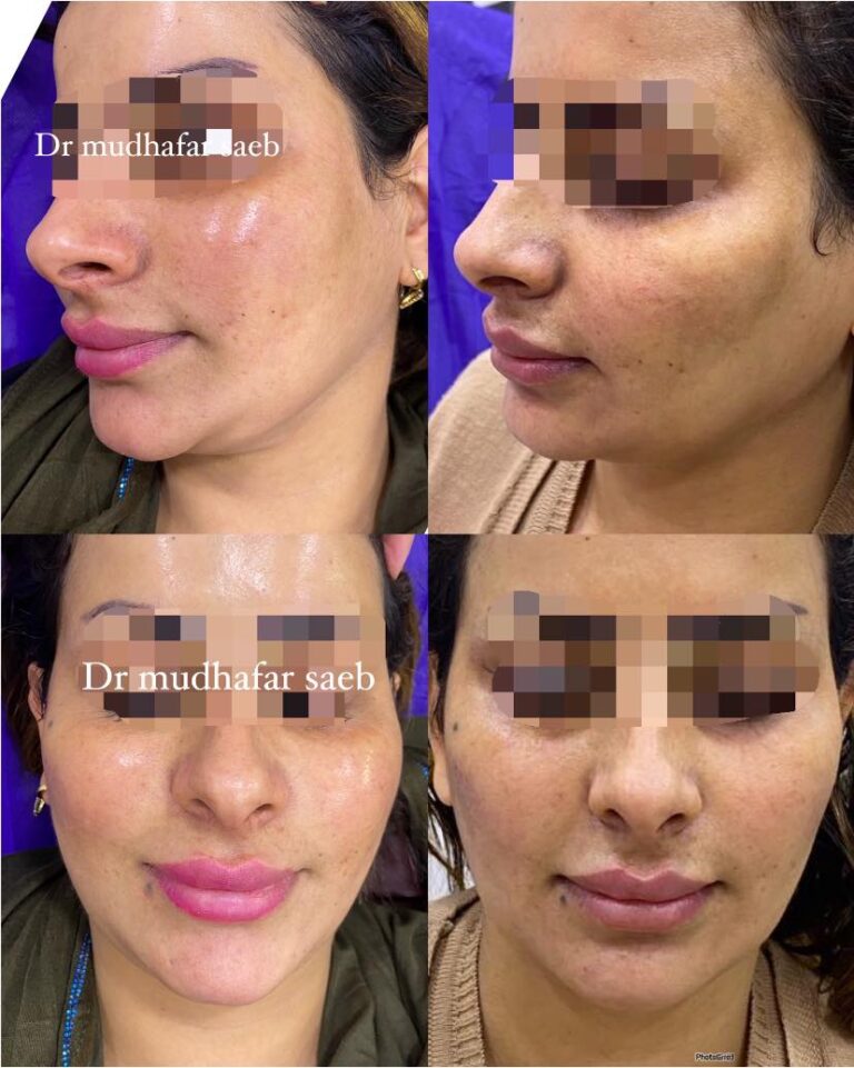 تنظيف البشره 2 768x961