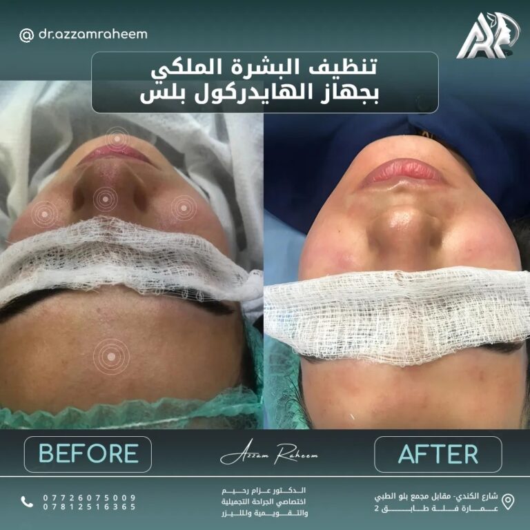 تنظيف الوجه 768x768