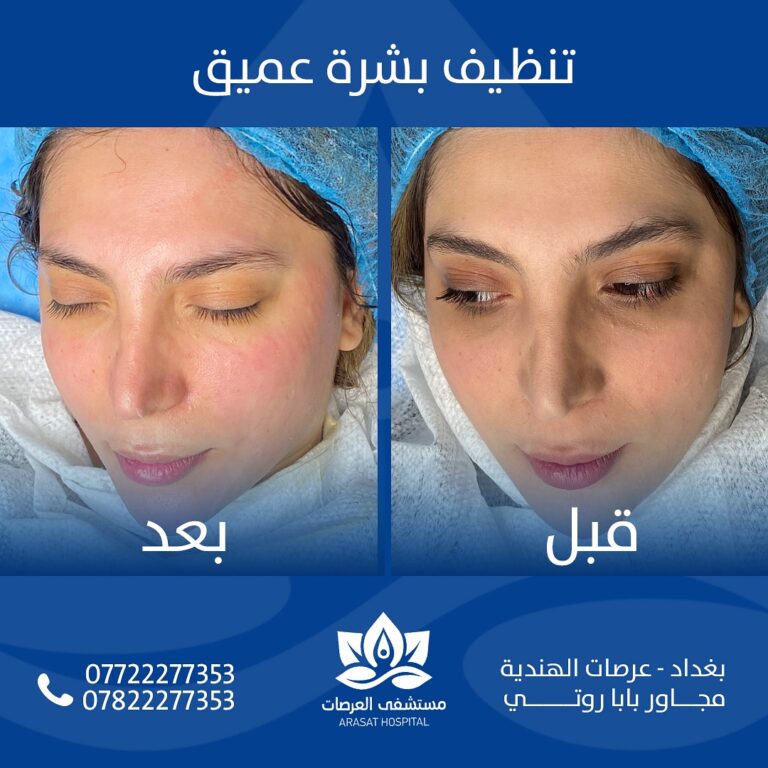 تنظيف بشره عميق 768x768