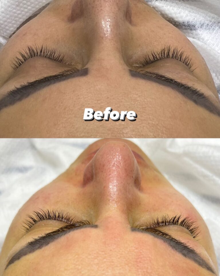 تنظيف عميق 768x960